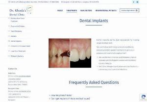Dental Implants Teeth Surgery Cost in Delhi Gurgaon - Get advantages of dental implants surgery through top teeth treatment clinic in Delhi and Gurgaon. New Delhi Dental Clinic provides you effective and more comfortable teeth implants with affordable costs. Make an appointment today and get your dental treatment scheduled.