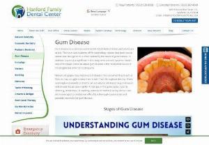Local Periodontal Disease California in Hanford - Gum Disease Hanford: Dr. Raiyani and his friendly dental team in Hanford enables patients to fight gum disease with the best possible tools