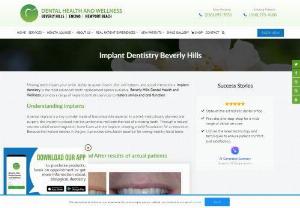 Implant dentistry Beverly Hills CA - Missing Teeth - Titanium Implants - Dr. Moldovan and her team provide a range of implant dentistry services to restore smiles and oral function for Beverly Hills, CA patients.
