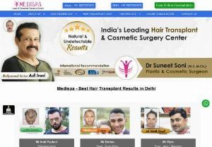 Hair Transplant Cost in Delhi | Hair Transplantation | Medispa - Medispa offers lowest hair transplant cost in Delhi. Medispa provides quality hair transplant services on affordable cost in Delhi.