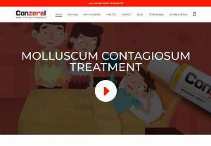 Molluscum Treatment - Have a problem with molluscum contagiosum? Here,  at Molluscum Clinic you will learn where to find best molluscum treatment. Learn how tu cure molluscum contagiosum,  read molluscum testimonials,  see molluscum photos. Learn about Conzerol,  best treatment for molluscum