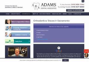 Orthodontics/Braces in Sacramento - Invisalign Braces - Affordable high quality Orthodontics Braces are available at Adams Dental Associates in Sacramento, CA 95825 with expert Orthodontist Dr. Kosta Adams & Team