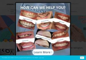 London City Smiles - Braces is no longer the only option for improving a person's smile. It is now possible to take advantage of Invisalign Braces in London. London City Smiles strives to provide the very best dental work and improving an individual's smile. Invisalign braces is just one option available to client.
