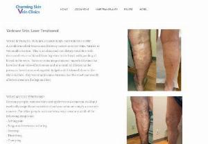 Care of Patients with Varicose Veins Treatment in Chicago - The consideration of patients with varicose veins and related endless venous maladies: Clinical practice rules of the Charming Skin Surgery and the American Venous