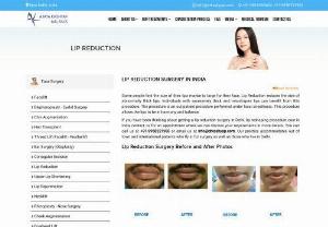 Lip Reduction Surgery in Delhi - There are many people who are not happy with the large size of their lips. For such people lip reduction surgery makes for the ideal option to consider as it reduces the size of abnormally thick lips. Worry not about the lip reduction surgery cost in Delhi for it depends on factors like whether it is performed as standalone procedure or in combination with other procedures,  experience of the surgeon and facilities provided at the clinic.