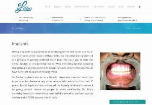 Dentist in vasant kunj new delhi - Do you have missing teeth? Dr. Lilly's dentistry is the bestDentist in Vasant Kunj New Delhioffering cut cost dental implants. For More Details Contact Us--9899765259.