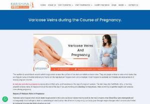 Varicose Veins during the Course of Pregnancy. - The swollen & raised blood vessels which bulge under or near the surface of the skin are called varicose veins. They are purple or blue in color which looks like an irregular curve or twisted and occurs mainly on the legs but can happen over vulva or rectum.