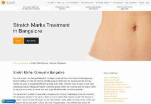 Laser Treatment for Stretch Marks in Bangalore | AK Clinics - Stretch Marks Removal Treatment in Bangalore - Feeling bad about your stretch marks? Don't worry,  AK Clinics provide best laser treatment for stretch marks in Bangalore at affordable cost. Get free consultation for stretch marks removal now!