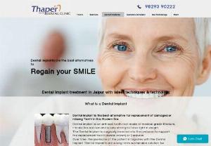 teeth replacement Dentist India - Thaper Dental Clinic is the most favourite dentist in India for Dental Implant surgeries