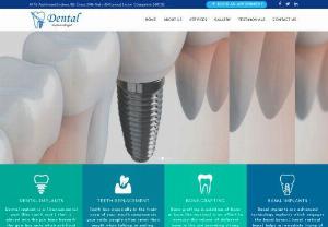 Dental Implants in Bangalore-Best Dental Implant Clinic - Best dental implant clinic Bangalore-We provide dental implants, tooth replacement, mini dental implants, cosmetic dentistry in the guidance of Dr Lokesh.