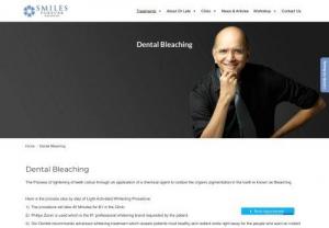 Dental Bleaching - Smilesforever - The process in which the lightening of teeth colour through an application of a chemical agent to oxidize the organic pigmentation in the teeth is called as Dental Bleaching. 

Here is the step by step process of Light-Activated Whitening Procedure.
1)  The procedure will take around 45 Minutes for the B1 in the Clinic.
2)  We use Philips Zoom as it is the  #1 professional whitening brand requested by our patients
3)  Our dentist recommends the most advanced whitening treatment which reveal