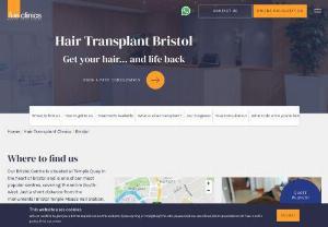 FUE Clinics Bristol - FUE Clinics are the UK's leading hair transplant and hair restoration services provider in the Yorkshire. Our Bristol centre is located in the heart of Bristol city centre adjacent to Bristol Temple Meads train station. Our Bristol centre is one of our longest serving locations and has always proven to be a popular choice for all our patients in the surrounding area(s). Our enviable reputation has been well contributed to Bristol in the field of hair transplantation.
