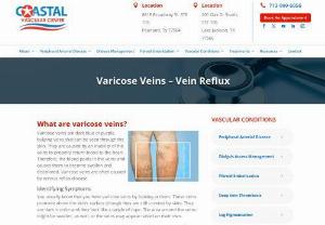 vein reflux - Coastal Vascular Center treats varicose veins. We use sclerotherapy, Endovenous Laser and other methods to treat of vein reflux.