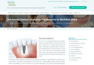 Get Teeth in 3 days | Basal Implants in Mumbai - 