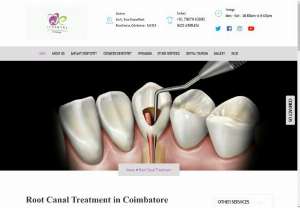 Root canal Treatment - Root Canal Treatment is performed when carious infection reaches the pulp (blood vessels and nerve supply to the tooth). Unlike the old techniques, RCT being performed with multiple sittings, WE Dental provides the advanced technique where the procedure is completed in a single sitting that takes about 20 minutes to 45 minutes depending on the teeth (front or back teeth).
This procedure is done under local anaesthesia. Dentists excavate the carious part of the teeth and prepare the access...