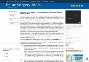 Cervical Spine Surgery Cost in India - Spine Surgery India is a widely acknowledged tourism company working in liaison with pre eminent spine hospitals in India where the cervical spine surgery is offered at an acceptable cost so that patients can get live a good-quality life without cervical spine ailments. The cervical spine surgery cost in India is about USD 7,000 that includes the cost of all the mediation and other minor treatments, there are no additional charges involved. The cost of both spinal decompression and spinal...