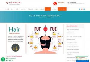 Fut and Fue Hair Transplant Treatment in Hyderabad - You can get a speedy tranformation from bald head to head with full of hair by FUT and FUE Hair Transplant in Vernon Skin & Hair Clinic Banjara hills Hyderabad
