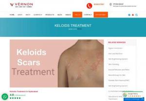 Keloids Treatment Doctor in Hyderabad - Sometimes body produces collagen when the wound is compeltly cured,this is called keloids scars.These are removable now at Vernon in Banjara hills,hyderabad. For more details u can contact us for book appointment 9100017567