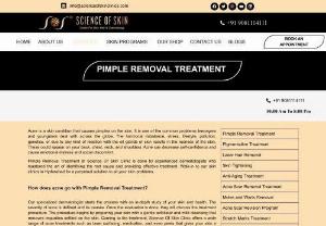 Pimple removal treatment in hyderabad. - Pimple and acne may not bother you much now. SOS gives the best treatment for pimples and acne. Pimple removal treatment can be done to any type of skin under the surveillance of the expert dermatologist. Pimple and acne treatment can be done effectively at SOS. Its time to get rid of the pimple and acne permanently.