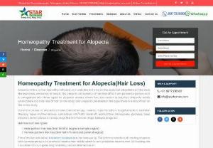 Alopecia Treatment in Homeopathy | Alopecia Symptoms and Causes | Home remedies for Alopecia - STAR Homeopathy has treated several people with Alopecia using constitutional homeopathic remedies and improved their overall wellbeing. These remedies are made of natural substances and are free from side effects.