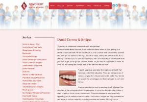 Dental Crowns | Dental Bridges | Implants Dentists | Brampton - Dental Crowns and Dental Bridges that match the color, height, texture and the overall appearance of your teeth, & last for a life time. Visit or call Roycrest Dental Center.
