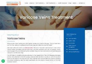 Best Varicose vein treatment in Pune at Karishma Vein Clinic - Karishma Vein Clinic has both surgical and non-surgical options to get you relief from Varicose Vein at an affordable cost. Karishma Vein Clinic provides one of the best varicose vein treatment in Pune.