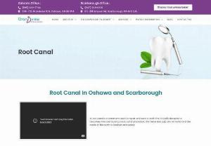Root Canal Treatment In Oshawa & Scarborough | Root Canal Specialist In Oshawa & Scarborough-Grandview Dental Clinic - Save your decayed tooth with root canal treatment with specialist of the Grandview Dental Clinic situated at Oshawa & Scarborough in Ontario.