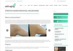 Stretch Marks Removal Melbourne - anti-aging Cosmetic & Laser - At anti-aging we use the new FDA approved treatment for stretch marks removal Melbourne, the 1540 Fraxel Laser and Radiofrequency, which delivers over 50% improvement after the treatment program. Visit us today for stretch marks removal Melbourne or Book us online.