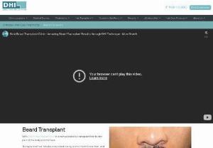 Beard Transplant in Chennai - Beard Transplant with Direct Hair Implantation restores the natural hair on the beard and the mustache.
