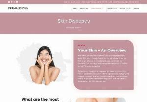Skin Diseases - Dermalicious - Your skin is the first line of defence that you have against the world. As a result, though, this protective outer lining is also the first to get affected by a number of issues, conditions and disorders, that can range from minor issues like rashes or pimples to major ones like skin cancer.