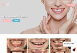 Smile Makeover Adelaide - Are you looking for an affordable and accessible smile makeover Adelaide? Our experience and highly sought after cosmetic dental implants team will work closely with you to achieve a natural-looking result in minimal time. We have access to state-of-the-art technology which enables us to fabricate veneers and dental implants in-house!