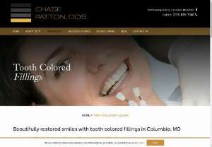 Tooth Colored Fillings Columbia MO - Consult dentist Dr. Chase Patton of Chase Patton DDS office in Columbia, MO to restore teeth to their natural beauty through tooth colored dental fillings