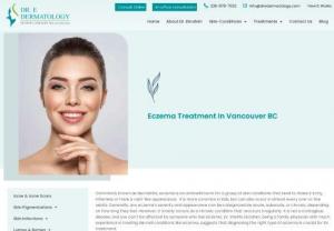 Eczema Treatment In Vancouver - Eczema treatment in Vancouver BC by Dr.Shehla Ebrahim. Dr Shehla Ebrahim is an experienced practitioner with a unique approach that has helped hundreds of Eczema patients to date.