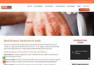 Best Eczema Treatment || Best Skin Care Treatment in Kurnool - Eczema refers to red, elevated, bumpy patches of skin associated with itching caused by different skin conditions. Moreover, this condition causes dry, itchy, flaky skin that can blister or crack.
