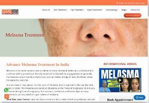 Best Advance Melasma Treatment || Best Skin Care Treatment in Kurnool - Melasma is a condition in which brown patches appear on parts of the skin exposed to the sun. This is common in darker-skin women, as well as women of reproductive age. (When it occurs in pregnant women, it is also called the 