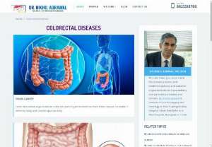 Colon Cancer Surgeon in Delhi ncr - Dr. Nikhil Agrawal is an experienced colon cancer surgeon in Delhi NCR. He has experience over 15 years of experience in treating gastrointestinal cancer, such as colon cancer, rectal cancer, stomach cancer, oesophageal cancer, liver cancer, gallbladder cancer, cholangiocarcinoma etc. Consult with top colon cancer specialist in Delhi NCR @ +91-9625518700