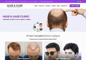 Hair fall treatment in udaipur - Your hair loss is a serious problem - if you're suffering from it. It's never fun having to look at your hair fall out in clumps, or having your hair thinning more and more day by day. But don't worry. Udaipur's best hair transplant clinic can make sure you look your best, no matter how bad your hair loss is. We at udaipur hair transplant in udaipur have best doctors and technology.