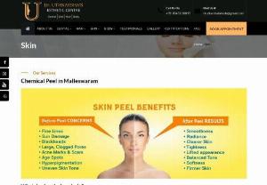 Chemical Peel in Malleswaram-Facial with Chemical Peel - We provide the best chemical peel in Malleswaram. You need good moisturizer and sunscreen after chemical peel treatment and book an appointment for skin care.