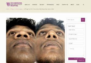 All You Need to Know About Alarplasty Nose Jobs in India - Read on to learn more about alarplasty nose jobs in India, including information about side effects, recovery, and benefits.