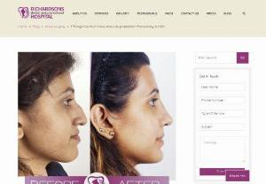 All You Need to Know About Augmentation Rhinoplasty in India - Read on to learn more about augmentation rhinoplasty in India, including information about cost, complications, side effects, & augmentation rhinoplasty procedure.