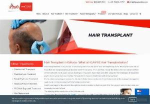 Hair Transplant Clinic In Kolkata, FUE Hair Transplantation Cost in Kolkata - Dr Paul's - Best Hair Transplant Clinic in Kolkata- Dr Paul's offers the most advanced Painless FUE hair transplantation surgery at an affordable Cost. Book Your Appointment.