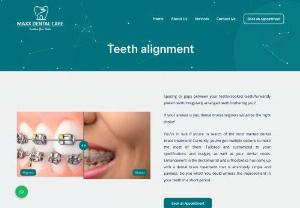 Dental Braces Treatment | Invisible Teeth Braces - Dealing with spacing or gaps issues in your teeth? Get the Dental braces treatment at Maxx Dental care. Invisible teeth braces are also available.
