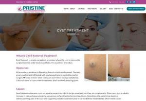 CYST Removal Treatment in Mumbai and Thane-Pristine Cosmesis - CYST Removal is surgical process where the It's removed under local anaesthesia. Get information on cosmetic surgeries and treatment from our experts. Call us for an appointment