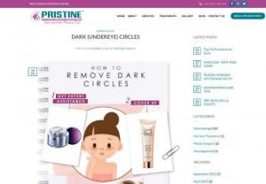 Undereye Dark Circle Removal Treatment-Pristine Cosmesis - Pristine cosmesis provides best dark circle (undereye) treatment. Get solution for all hair problem and cosmetic problems from our experts. Call us for an appointment