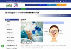 Sinus Treatment in Hyderabad | MAA ENT Hosptials - Offering comprehensive treatment for Sinus Infection, Chronic Sinusitis Treatment, and Sinus Surgery in Hyderabad. High Success Sinus Treatment in Hyderabad.