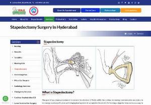 Stapedectomy Surgery in Hyderabad | MAA ENT Hospitals - Stapedectomy Surgery with experienced ENT specialists at MAA ENT Hospitals. Schedule an Appointment with best ENT Hospital In Hyderabad for your stapedectomy surgery. Get estimated cost for stapedectomy surgery.