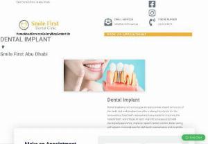 dental implant in abu dhabi - For dental implant in abu dhabi, you can visit Smile First Dental Clinic, they provide amazing service to their patients at affordable rates.