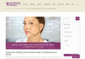 All That You Must Know About Facial Skin Grafting Scar Revision In India - Read on to learn more about facial skin grafting scar revision in India, including treatment, cost, and the best hospital.