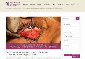 Effective Eyelid Laceration Treatment in India | Richardsons Hospital - Trust Richardsons Hospital for top-notch eyelid laceration treatment in India. Our experienced surgeons provide the best care for quick recovery.