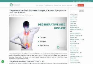Degenerative Disk Disease: Stages, Causes, Symptoms and Treatment - Are you experiencing back pain, stiffness, or reduced mobility? If so, you may be suffering from degenerative disc disease. Degenerative disc disease is a condition that affects the spinal discs, which are the soft, spongy cushions between the vertebrae in your spine. Over time, these discs can break down and lose their ability to cushion the spine, leading to pain and reduced mobility. 